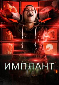 Имплант 2021